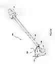 Fig. 07 - Expandable annuloplasty ring and associated ring holder