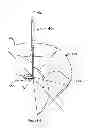 Fig. 14 - Expandable annuloplasty ring and associated ring holder