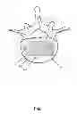 Fig. 08 - Method and apparatus for spinal interbody fusion including fixation or locking plate