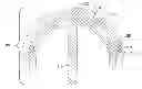 Fig. 01 - Prosthetic joint assembly and prosthetic joint member