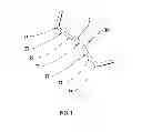Fig. 02 - Prosthetic joint assembly and prosthetic joint member