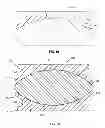 Fig. 13 - Prosthetic joint assembly and prosthetic joint member
