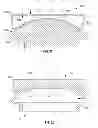 Fig. 14 - Prosthetic joint assembly and prosthetic joint member