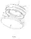 Fig. 16 - Prosthetic joint assembly and prosthetic joint member