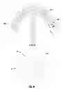 Fig. 26 - Prosthetic joint assembly and prosthetic joint member