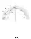 Fig. 36 - Prosthetic joint assembly and prosthetic joint member