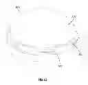 Fig. 41 - Prosthetic joint assembly and prosthetic joint member