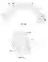 Fig. 45 - Prosthetic joint assembly and prosthetic joint member