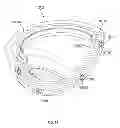 Fig. 49 - Prosthetic joint assembly and prosthetic joint member