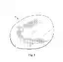 Fig. 04 - Laser cutting