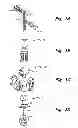 Fig. 02 - Process fluid pressure transmitter with separated sensor and sensor electronics