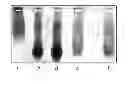 Fig. 01 - ELECTROPHORETICALLY ENHANCED DETECTION OF ANALYTES ON A SOLID SUPPORT