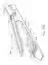 Fig. 216 - Surgical stapler with stationary staple drivers