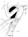 Fig. 03 - Bucket sling