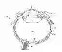 Fig. 01 - Eye covering and refractive correction methods and apparatus having improved tear flow, comfort, and/or applicability