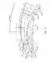Fig. 06 - Eye covering and refractive correction methods and apparatus having improved tear flow, comfort, and/or applicability