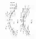 Fig. 20 - Eye covering and refractive correction methods and apparatus having improved tear flow, comfort, and/or applicability