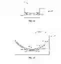 Fig. 28 - Eye covering and refractive correction methods and apparatus having improved tear flow, comfort, and/or applicability