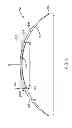 Fig. 32 - Eye covering and refractive correction methods and apparatus having improved tear flow, comfort, and/or applicability