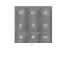 Fig. 06 - Normalization of retinal nerve fiber layer thickness measurements made by time domain-optical coherence tomography