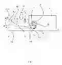 Fig. 06 - Reciprocating laser scanning device