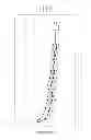 Fig. 05 - Drug delivery system