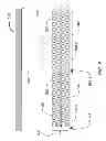 Fig. 07 - ACOUSTIC INSULATION WITH PERFORMANCE ENHANCING SUB-STRUCTURE