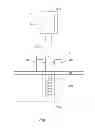 Fig. 04 - APPARATUS FOR DETECTING BONE DEFECTS AND DENTAL ABUTMENT THEREOF