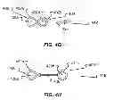 Fig. 09 - Orientation arbitration