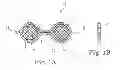 Fig. 02 - Expandable implant system