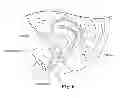 Fig. 08 - Synthetic urethra with closure device