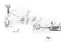 Fig. 02 - DYNAMIC SURGICAL FLUID SENSING