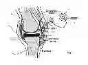 Fig. 04 - DYNAMIC SURGICAL FLUID SENSING