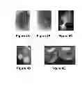 Fig. 09 - Systems and methods for visualizing ablated tissue