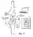 Fig. 03 - Orthopedic insert measuring system for having a sterilized cavity