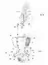 Fig. 02 - INFLATABLE COMPRESSSION SLEEVE