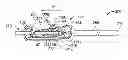 Fig. 01 - Safety catheter