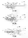 Fig. 04 - Safety catheter