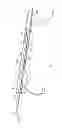 Fig. 04 - Irrigation system and clip for a surgical instrument