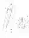 Fig. 04 - Solid-body catheter including lateral distal openings