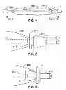 Fig. 02 - Catheter Advancement