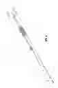 Fig. 02 - System and method for performing an electrosurgical procedure using an ablation device with an integrated imaging device