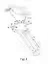 Fig. 02 - Patella resection assembly