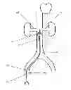 Fig. 01 - Introducer placement system