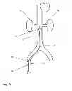 Fig. 06 - Introducer placement system