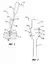 Fig. 02 - Compliant inserter for implants