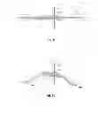 Fig. 08 - Knotted suture end effector