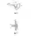 Fig. 09 - Knotted suture end effector