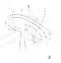 Fig. 02 - ELECTRODE ARRANGEMENT