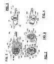 Fig. 03 - Adjustable spine distraction implant